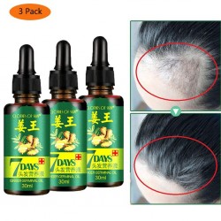 3 pezzi - liquido di crescita dei capelli - essenza zenzero - 7 giorni di trattamento