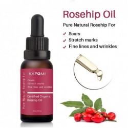 Rosehip essential oil - scar repair / skin care / acne treatment - 10ml