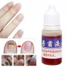 Medicina cinese - riparazione unghie per onicomicosi - funghi alle unghie - 10 ml