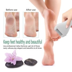 Electric foot file - callus / dead skin remover - feet careFeet