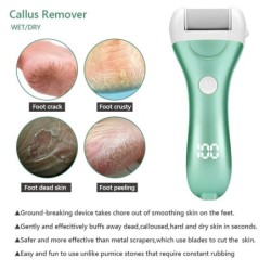 Electric foot file - callus / dead skin remover - feet careFeet