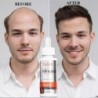 Hair growth essential oil - anti hair loss liquid - serumHair