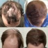 Huile essentielle de pousse des cheveux - liquide anti chute de cheveux - sérum