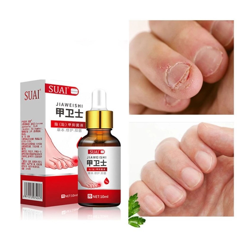Gel per la rimozione dei funghi dell'unghia del piede - siero - anti infezione / paronichia / onicomicosi - 10ml