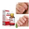 Toenail fungus removal gel - serum - anti infection / paronychia / onychomycosis - 10mlTreatment