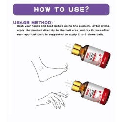 Toenail fungus removal gel - serum - anti infection / paronychia / onychomycosis - 10mlTreatment