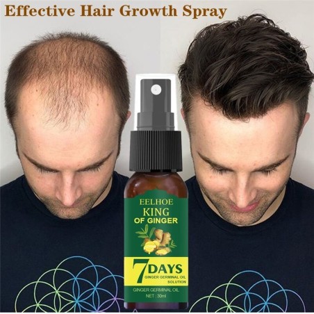 Essenza per la crescita dei capelli - spray contro la caduta dei capelli