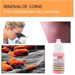 Skin tag removal - foot warts - medical liquid - 10ml - 2 piecesSkin