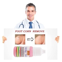 Skin tag removal - foot warts - medical liquid - 10ml - 2 piecesSkin