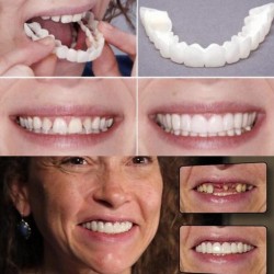 Coperchio denti in silicone - dentura 2 pezzi